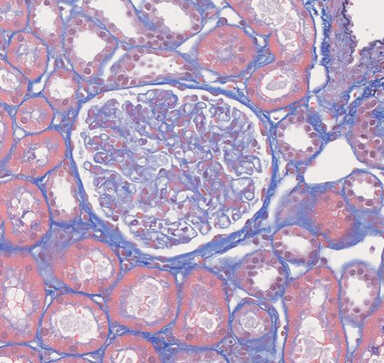 [MT] 10% Neutral buffered formalin