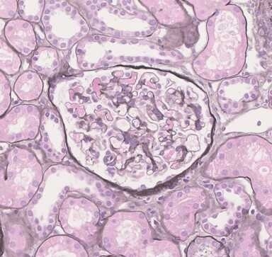 [PAM] 10% Neutral buffered formalin