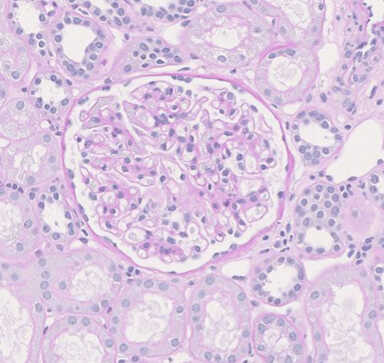 [PAS] 10% Neutral buffered formalin