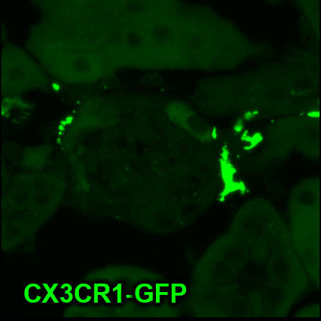 CX3CR1-GFP