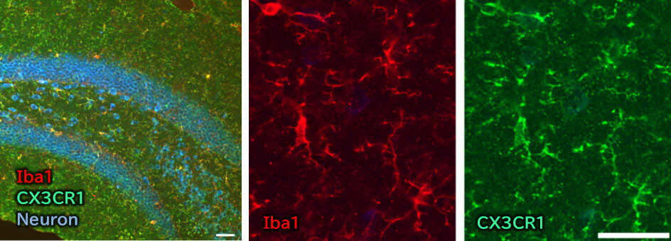 Immunohistochemistry