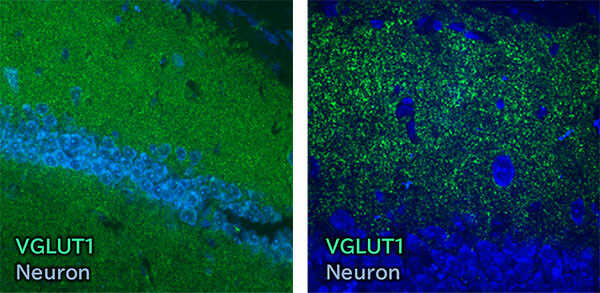 Immunohistochemistry