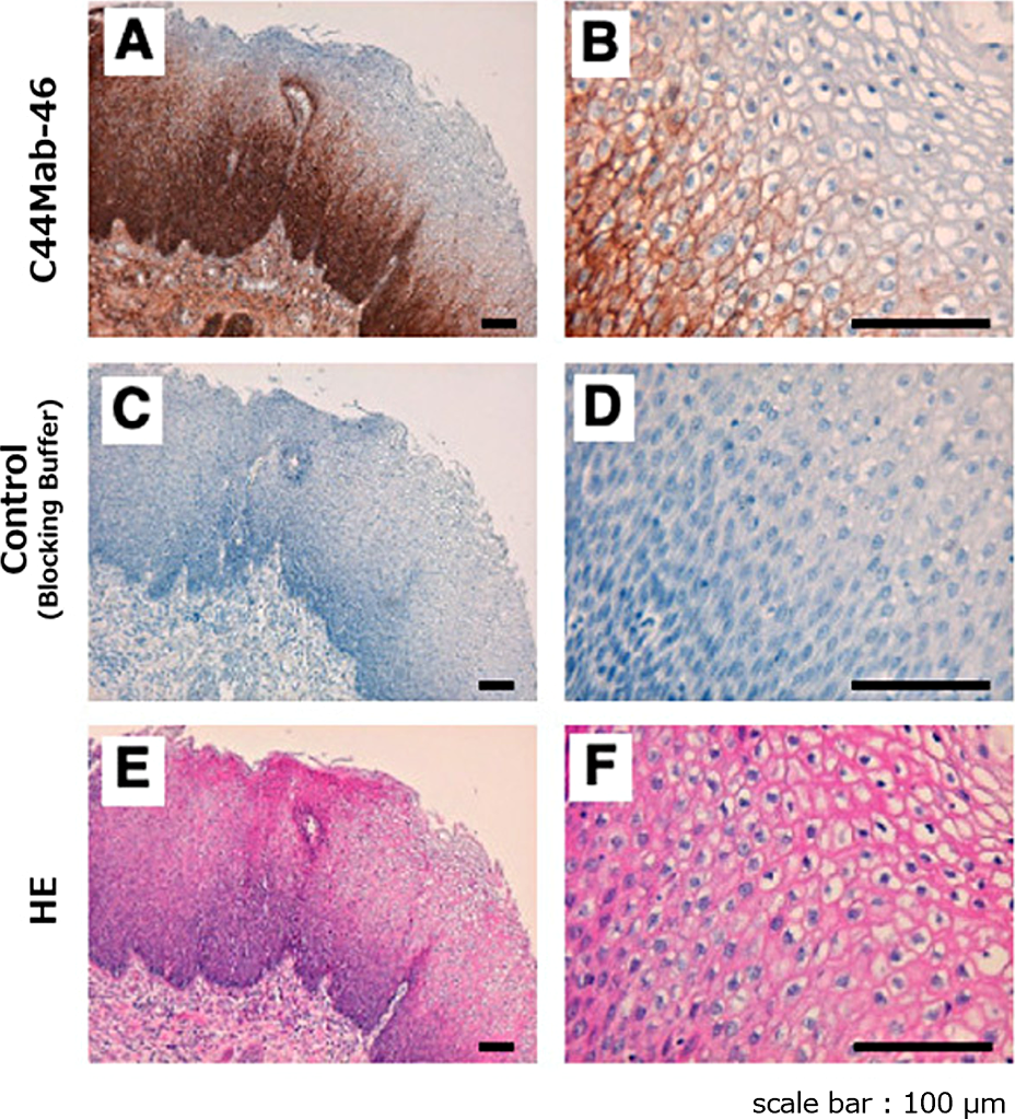 Immunohistochemistry