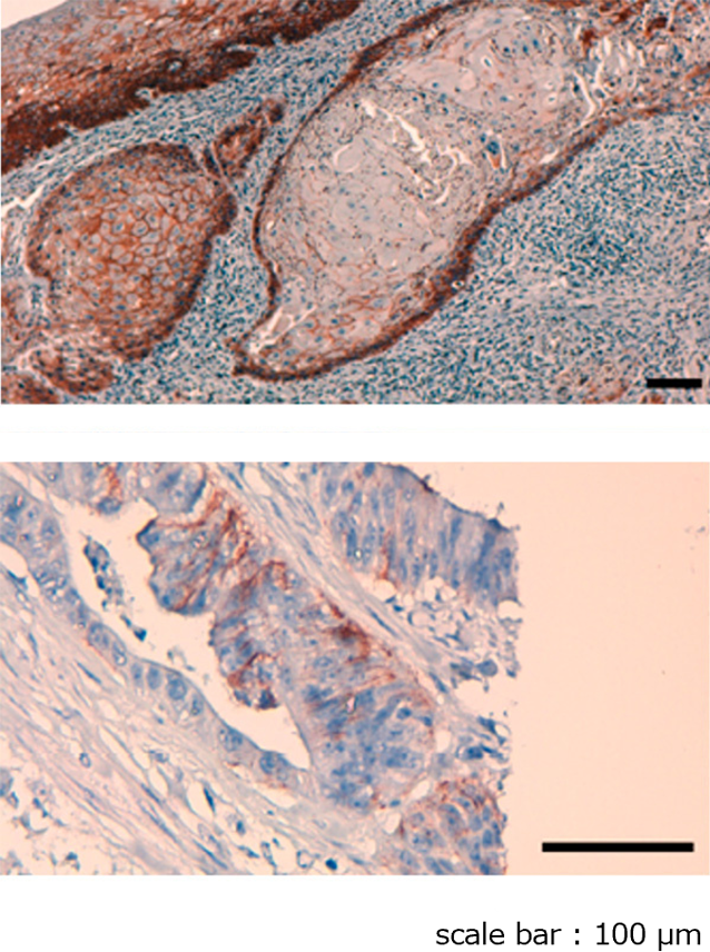 Anti CD44v6, Monoclonal Antibody