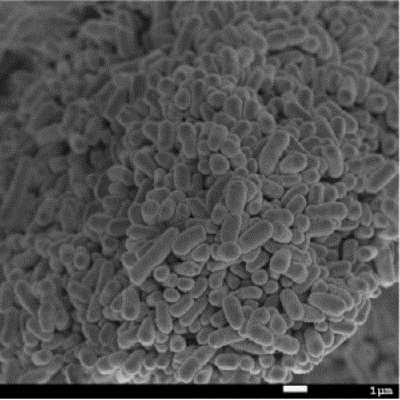 Phocaeicola vulgatus