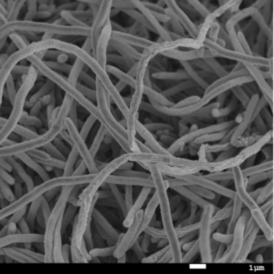 Faecalibacterium duncaniae