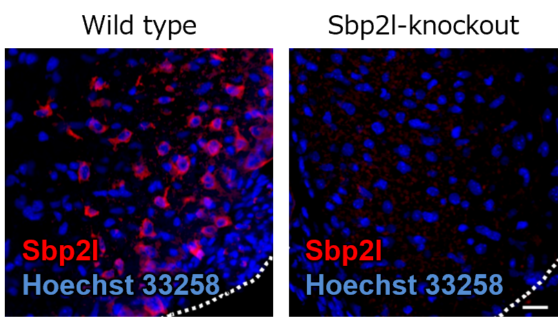 Immunohistochemstry of Sbp2l-knockout mice