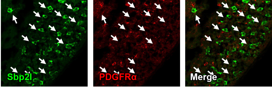Double staining with oligodendrocyte precursor cell markers