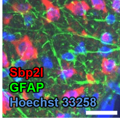Double staining with astrocyte markers