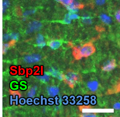 Double staining with astrocyte markers