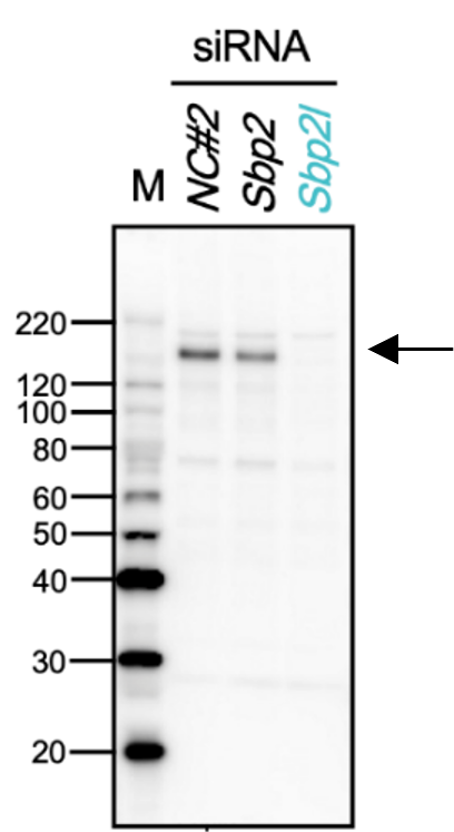 Sbp2l Knockdown by Sbp2l-specific siRNA