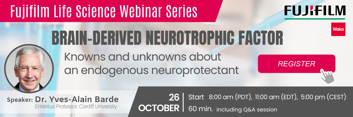 [Webinar] Brain-derived neurotrophic factor:<br>Knowns and unknowns about an endogenous neuroprotectant<br>Speaker: Dr. Yves-Alain Barde | Emeritus Professor, Cardiff University