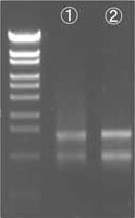 Data2. Electrophoresis