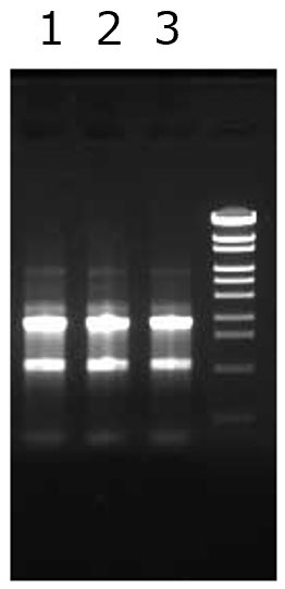 RNA extraction from Hela cells