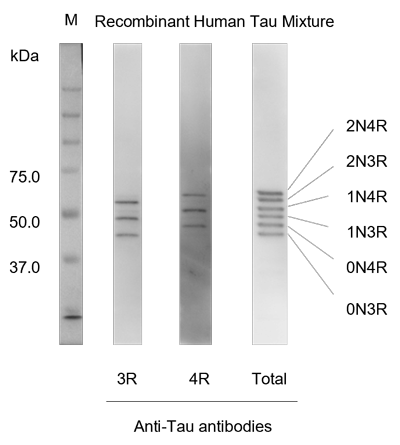 Detection of isoforms