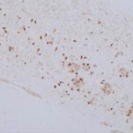 Immunohistochemistry