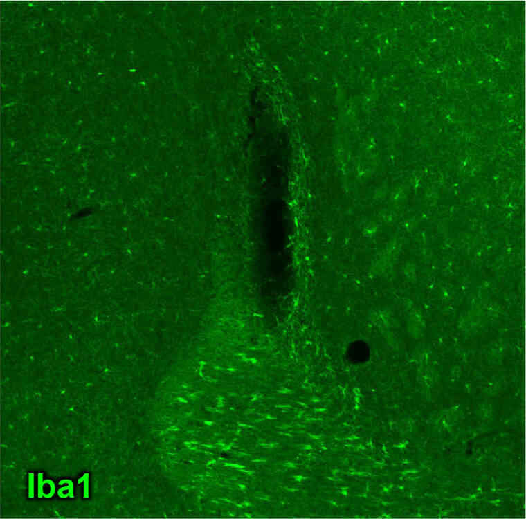 Microglia Remover sample image