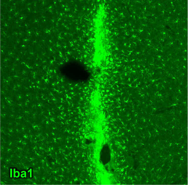 Microglia Remover(for Control)sample image