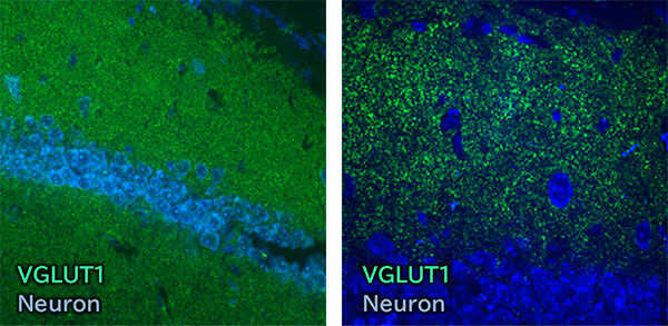 Immunohistochemistry
