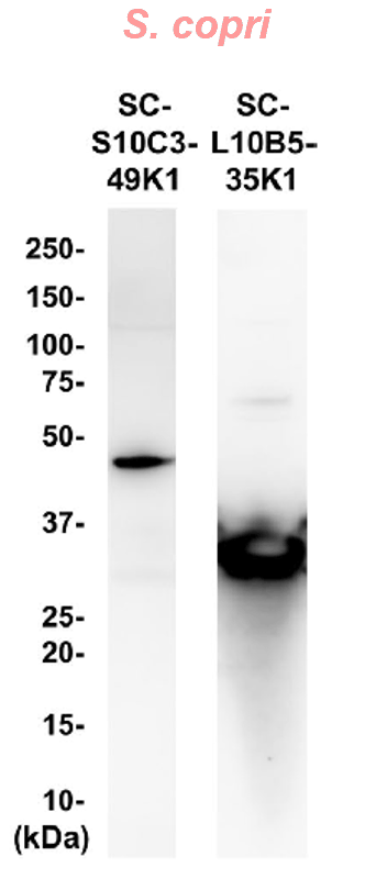 ウエスタンブロッティング