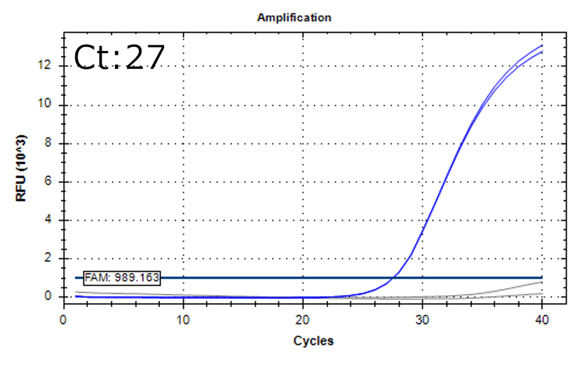 Pseudomonas aeruginosa