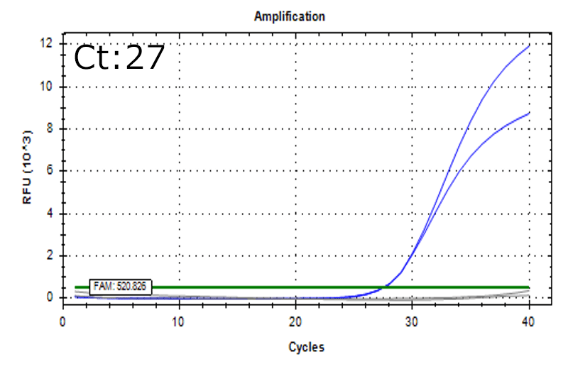Pseudomonas aeruginosa