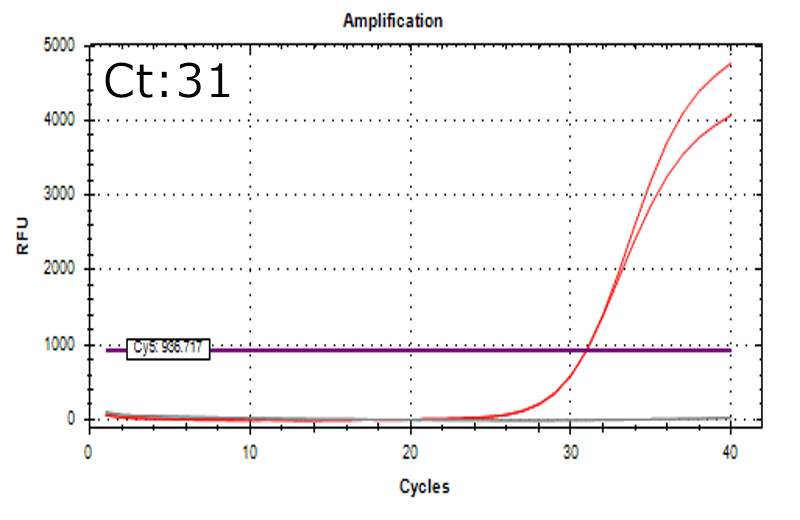 Aspergillus brasiliensis